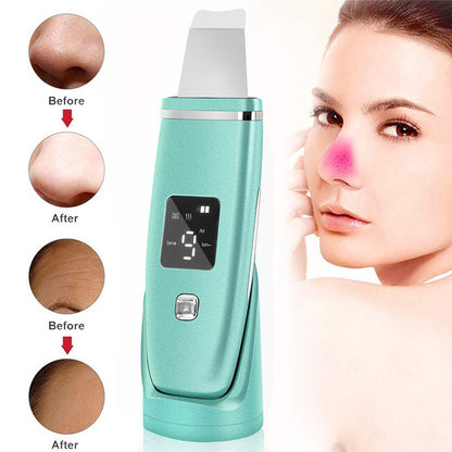 Vibration Blackhead Remover